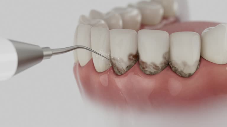 Reliable Emergency Dentist contractor in Madison, WV by Smile Center Dentistry